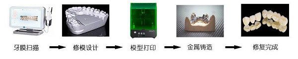 光固化3D打印机推动牙科数字化生态链发展新变革